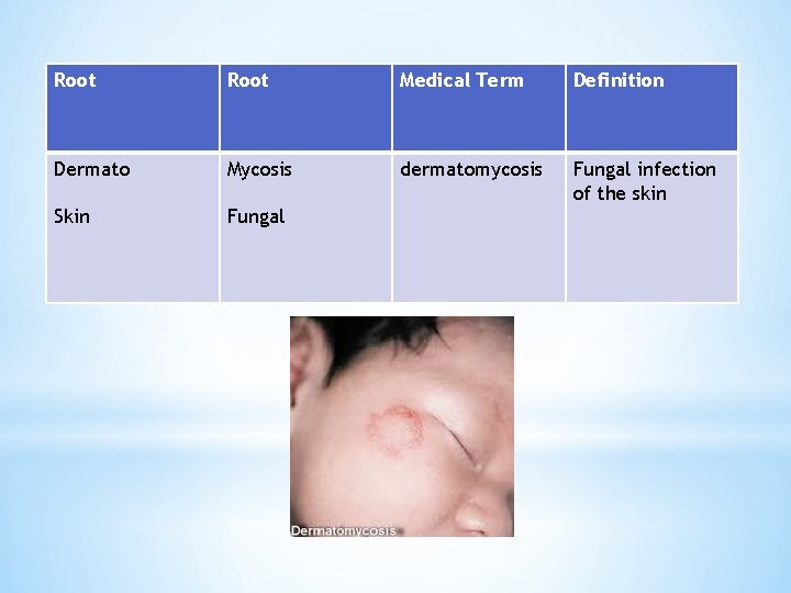 Root Medical Term Definition Dermato Mycosis dermatomycosis Fungal infection of the skin Skin Fungal