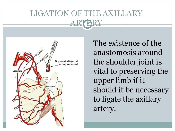 LIGATION OF THE AXILLARY 46 ARTERY The existence of the anastomosis around the shoulder LIGATION OF THE AXILLARY 46 ARTERY The existence of the anastomosis around the shoulder