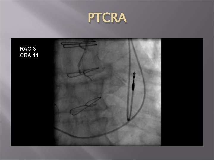 PTCRA RAO 3 CRA 11 PTCRA RAO 3 CRA 11