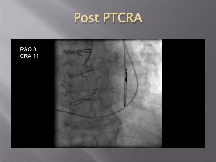 Post PTCRA RAO 3 CRA 11 Post PTCRA RAO 3 CRA 11