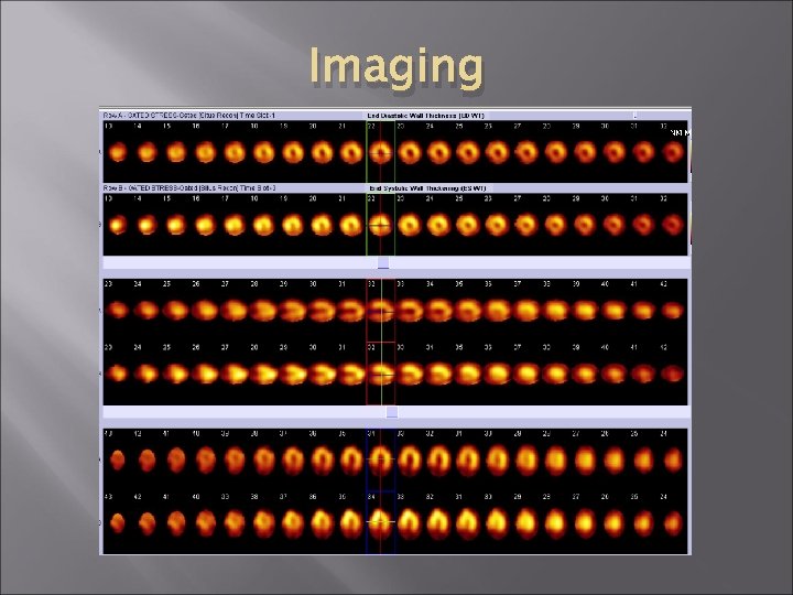 Imaging Imaging