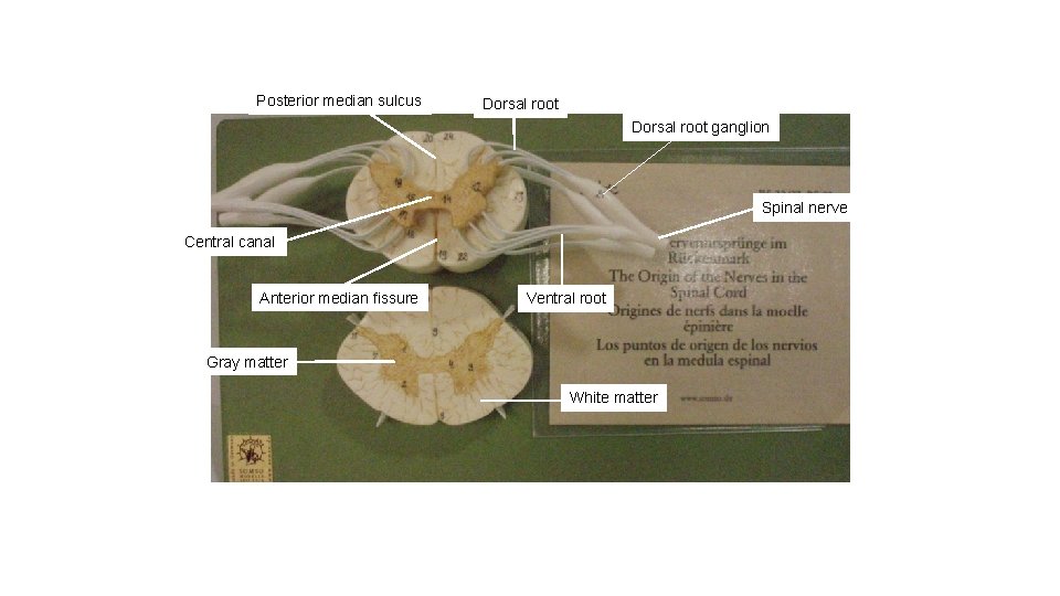 Posterior median sulcus Dorsal root ganglion Spinal nerve Central canal Anterior median fissure Ventral