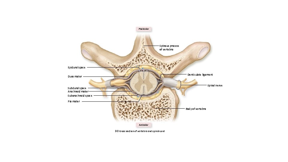 Posterior Spinous process of vertebra Epidural space Denticulate ligament Dura mater Spinal nerve Subdural