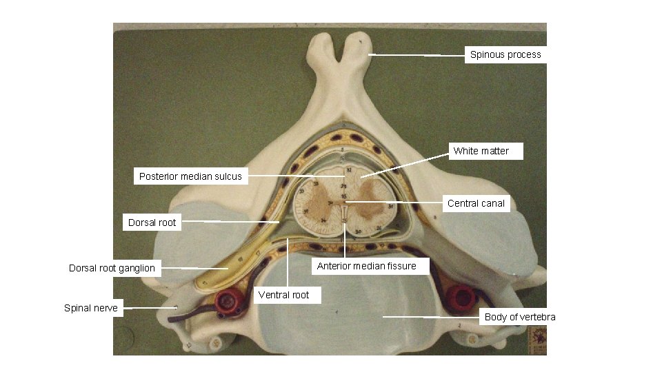 Spinous process White matter Posterior median sulcus Central canal Dorsal root Anterior median fissure