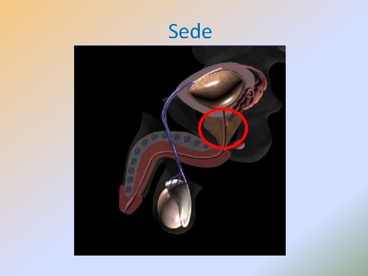 Sede 