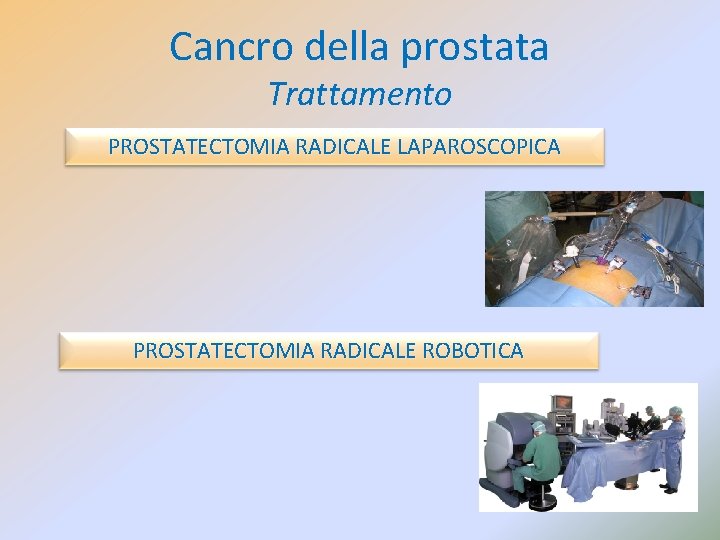 Cancro della prostata Trattamento PROSTATECTOMIA RADICALE LAPAROSCOPICA PROSTATECTOMIA RADICALE ROBOTICA 