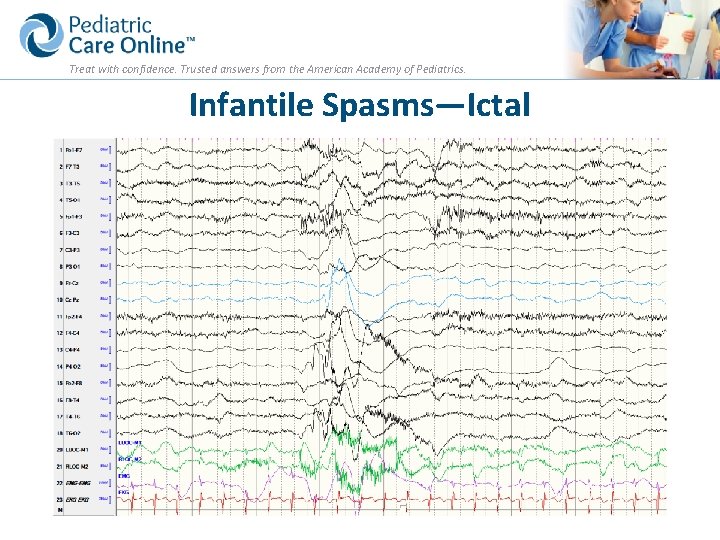 Treat with confidence. Trusted answers from the American Academy of Pediatrics. Infantile Spasms—Ictal 