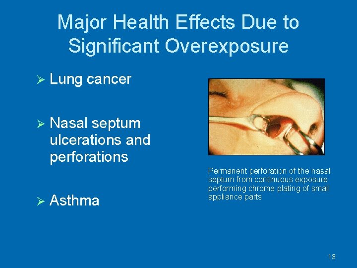 Major Health Effects Due to Significant Overexposure Lung cancer Nasal septum ulcerations and perforations
