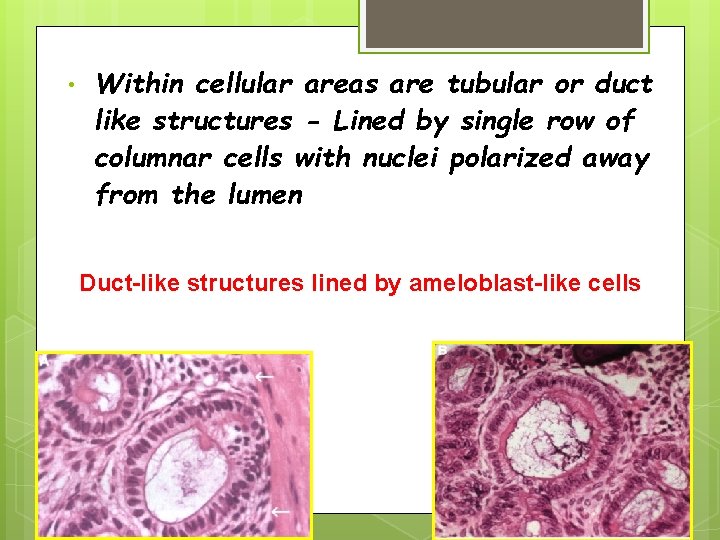  • Within cellular areas are tubular or duct like structures - Lined by