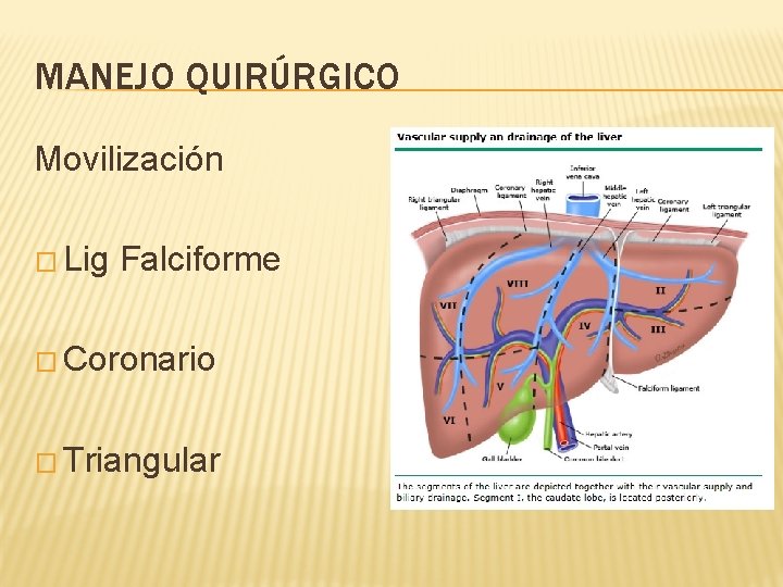 MANEJO QUIRÚRGICO Movilización � Lig Falciforme � Coronario � Triangular 