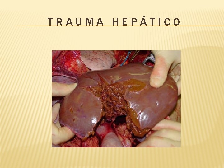 TRAUMA HEPÁTICO 