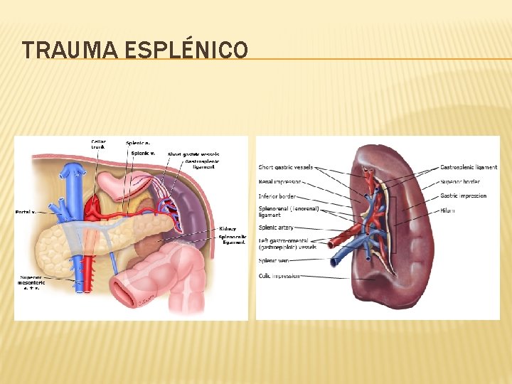 TRAUMA ESPLÉNICO 