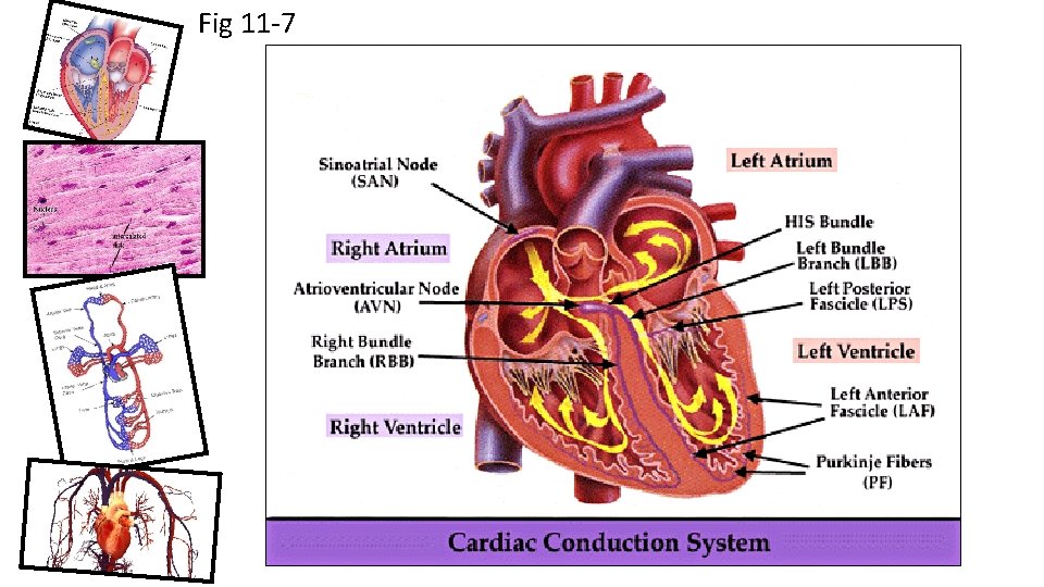 Fig 11 -7 