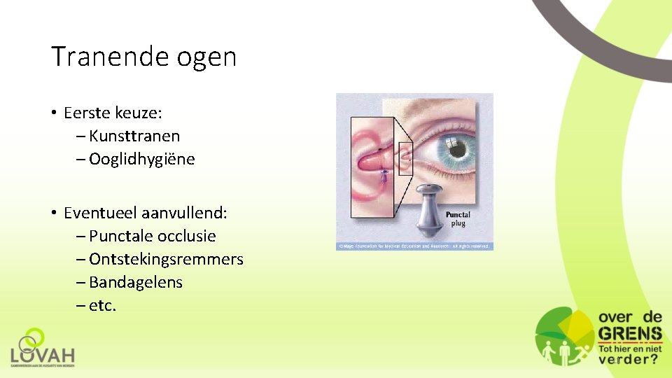 Tranende ogen • Eerste keuze: – Kunsttranen – Ooglidhygiëne • Eventueel aanvullend: – Punctale