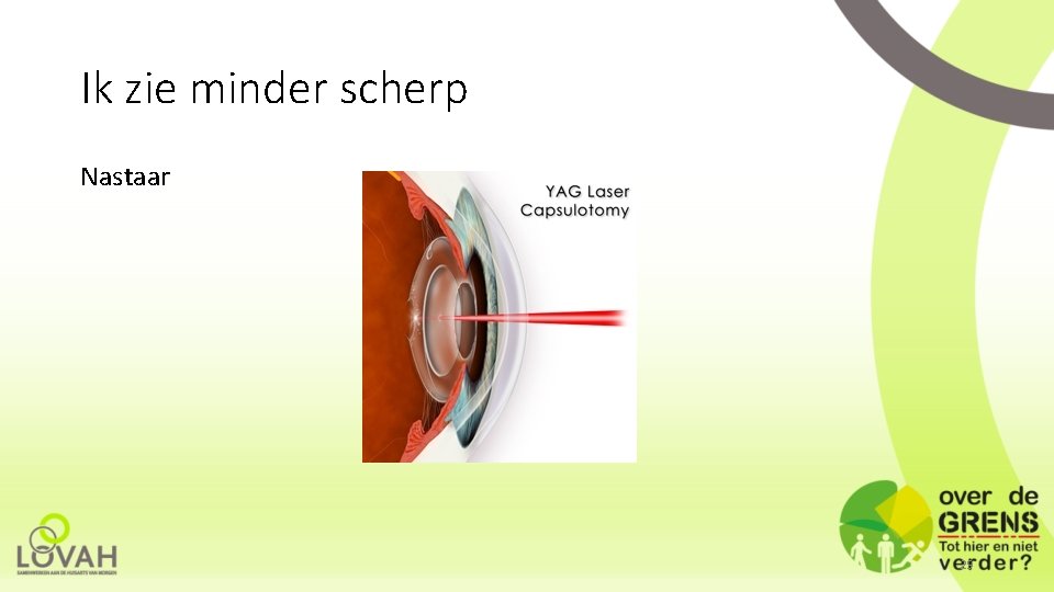 Ik zie minder scherp Nastaar 29 