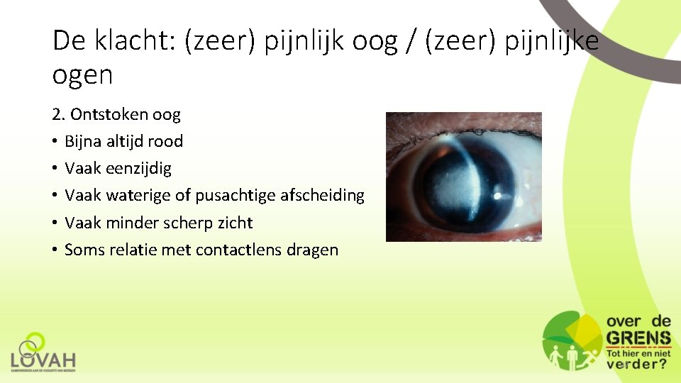 De klacht: (zeer) pijnlijk oog / (zeer) pijnlijke ogen 2. Ontstoken oog • Bijna