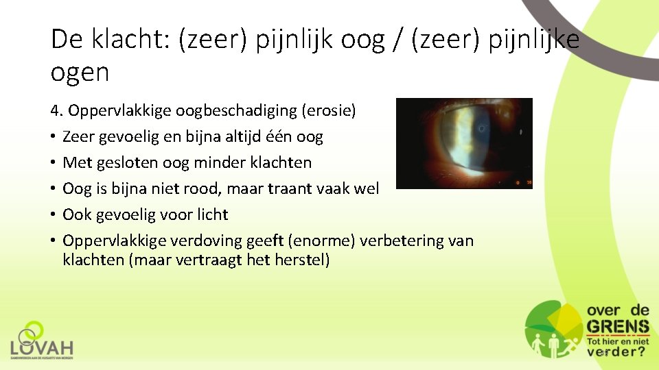 De klacht: (zeer) pijnlijk oog / (zeer) pijnlijke ogen 4. Oppervlakkige oogbeschadiging (erosie) •