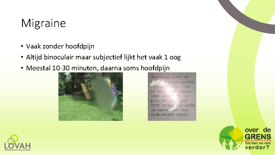 Migraine • Vaak zonder hoofdpijn • Altijd binoculair maar subjectief lijkt het vaak 1