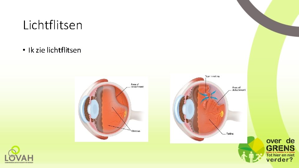 Lichtflitsen • Ik zie lichtflitsen 50 