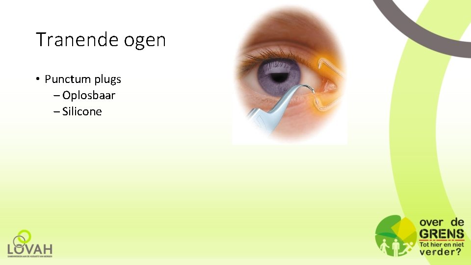 Tranende ogen • Punctum plugs ‒ Oplosbaar ‒ Silicone 9 