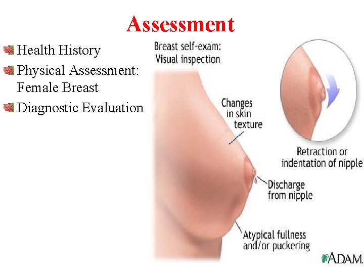Assessment Health History Physical Assessment: Female Breast Diagnostic Evaluation 
