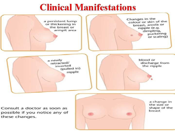 Clinical Manifestations 