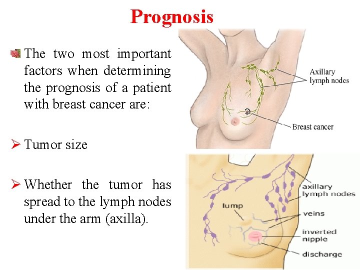 Prognosis The two most important factors when determining the prognosis of a patient with
