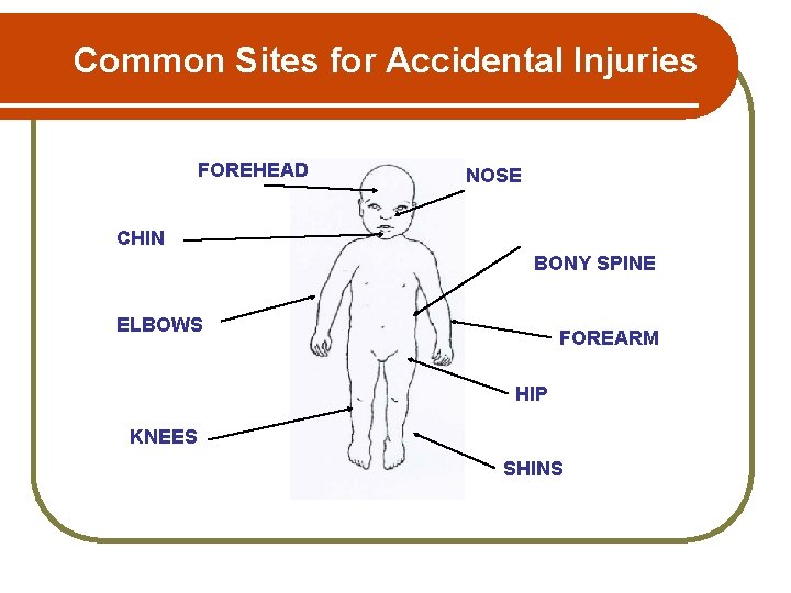 Common Sites for Accidental Injuries FOREHEAD NOSE CHIN BONY SPINE ELBOWS FOREARM HIP KNEES