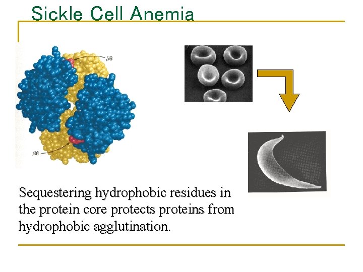 Sickle Cell Anemia Sequestering hydrophobic residues in the protein core protects proteins from hydrophobic