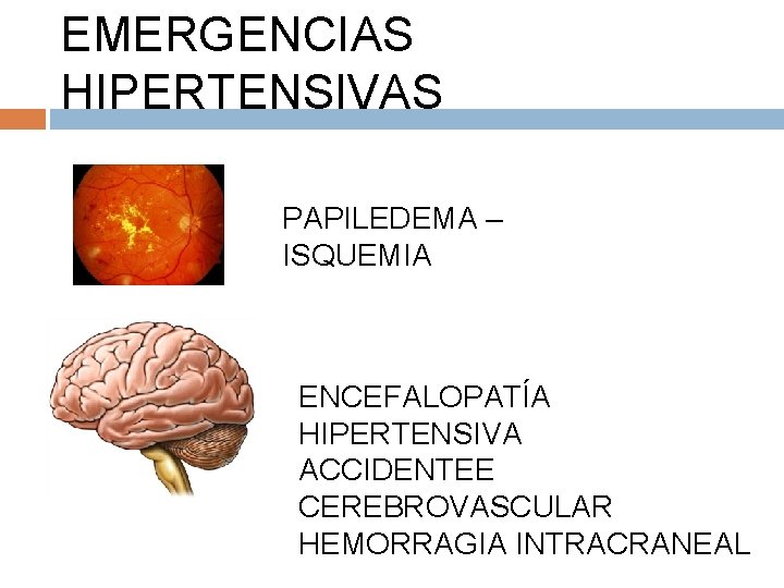 EMERGENCIAS HIPERTENSIVAS PAPILEDEMA – ISQUEMIA ENCEFALOPATÍA HIPERTENSIVA ACCIDENTEE CEREBROVASCULAR HEMORRAGIA INTRACRANEAL 