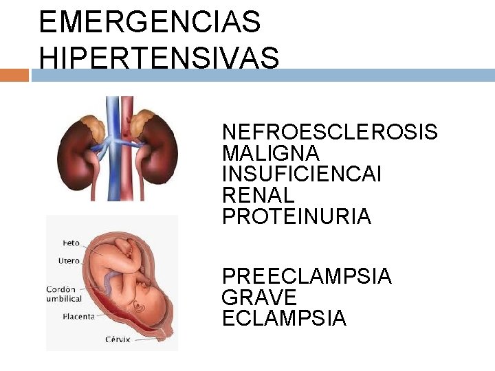 EMERGENCIAS HIPERTENSIVAS NEFROESCLEROSIS MALIGNA INSUFICIENCAI RENAL PROTEINURIA PREECLAMPSIA GRAVE ECLAMPSIA 