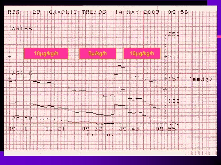 10µg/kg/h 5µ/kg/h 10µg/kg/h 