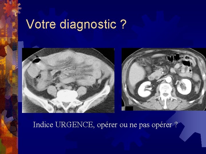 Votre diagnostic ? Indice URGENCE, opérer ou ne pas opérer ? 