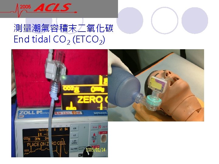 2005 測量潮氣容積末二氧化碳 End tidal CO 2 (ETCO 2) 