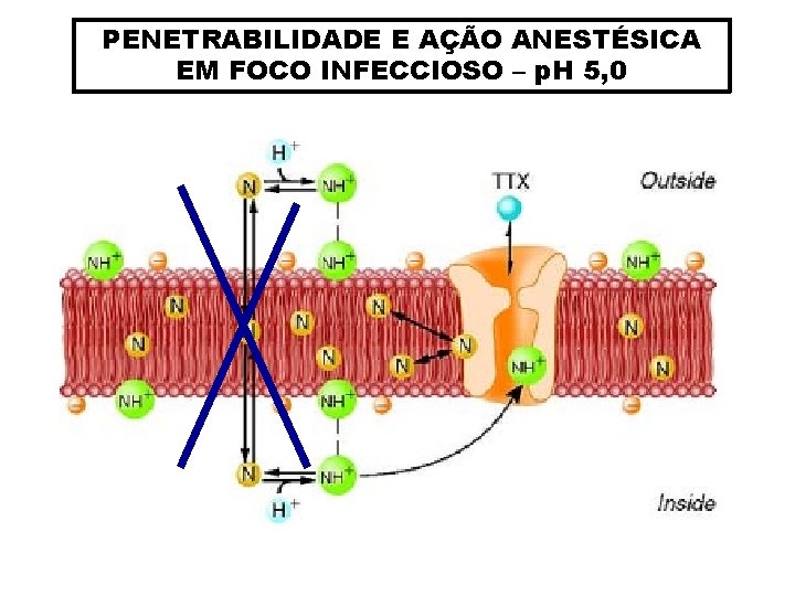 PENETRABILIDADE E AÇÃO ANESTÉSICA EM FOCO INFECCIOSO – p. H 5, 0 