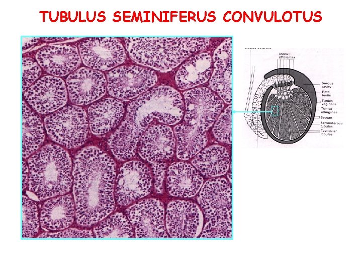 TUBULUS SEMINIFERUS CONVULOTUS TUBULUS SEMINIFERUS CONVULOTUS