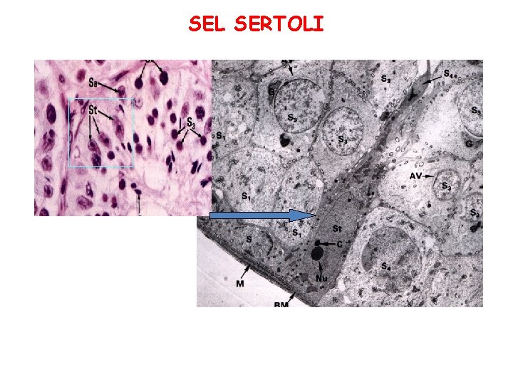 SEL SERTOLI SEL SERTOLI