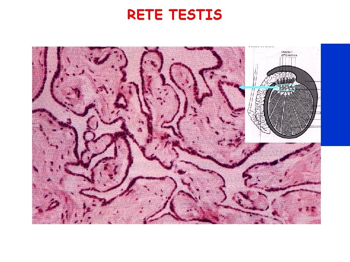 RETE TESTIS RETE TESTIS