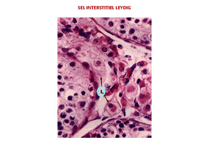 SEL INTERSTITIEL LEYDIG SEL INTERSTITIEL LEYDIG