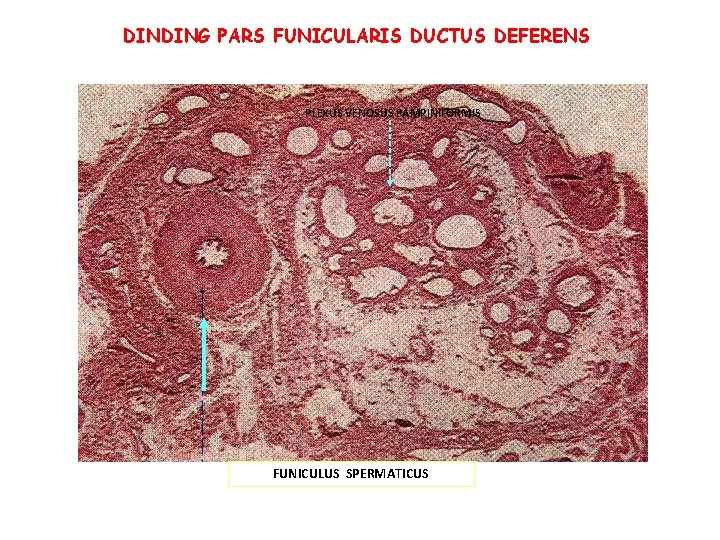 DINDING PARS FUNICULARIS DUCTUS DEFERENS PLEXUS VENOSUS PAMPINIFORMIS FUNICULUS SPERMATICUS DINDING PARS FUNICULARIS DUCTUS DEFERENS PLEXUS VENOSUS PAMPINIFORMIS FUNICULUS SPERMATICUS
