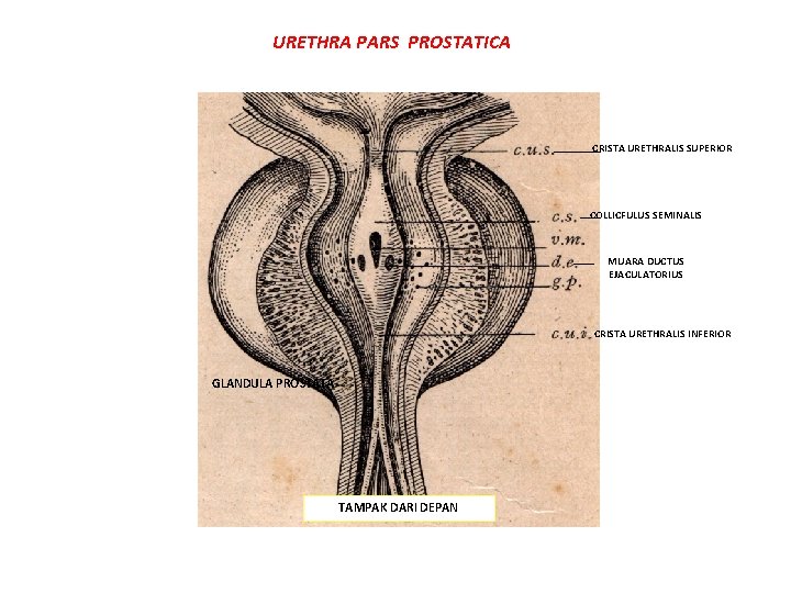 URETHRA PARS PROSTATICA CRISTA URETHRALIS SUPERIOR COLLICFULUS SEMINALIS MUARA DUCTUS EJACULATORIUS CRISTA URETHRALIS INFERIOR URETHRA PARS PROSTATICA CRISTA URETHRALIS SUPERIOR COLLICFULUS SEMINALIS MUARA DUCTUS EJACULATORIUS CRISTA URETHRALIS INFERIOR