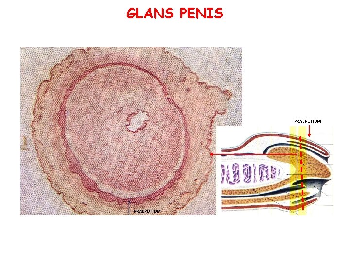 GLANS PENIS PRAEPUTIUM GLANS PENIS PRAEPUTIUM