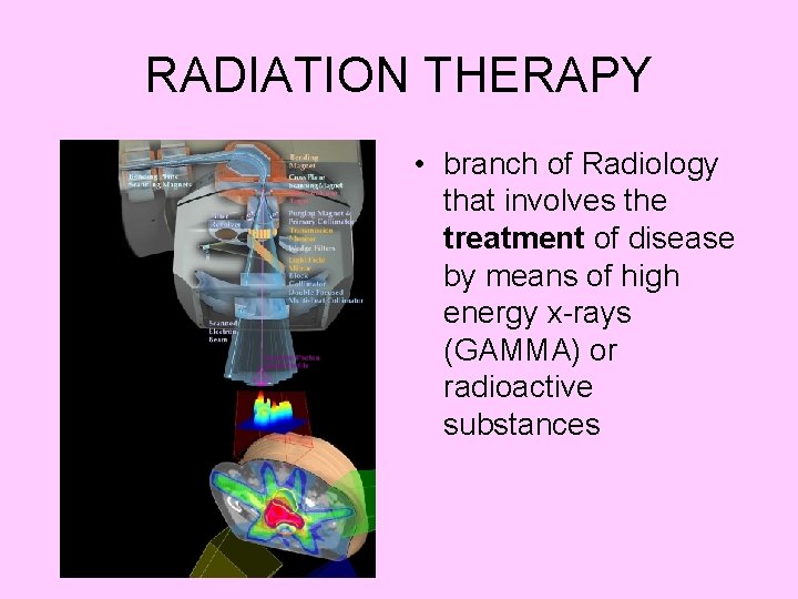 RADIATION THERAPY • branch of Radiology that involves the treatment of disease by means