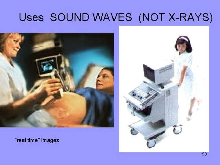Uses SOUND WAVES (NOT X-RAYS) “real time” images 93 