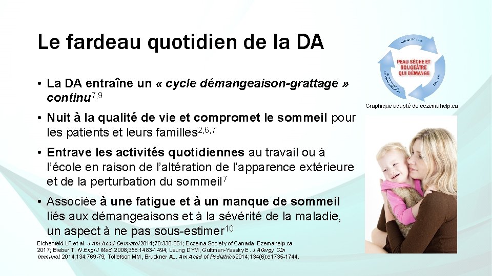 Le fardeau quotidien de la DA • La DA entraîne un « cycle démangeaison-grattage Le fardeau quotidien de la DA • La DA entraîne un « cycle démangeaison-grattage