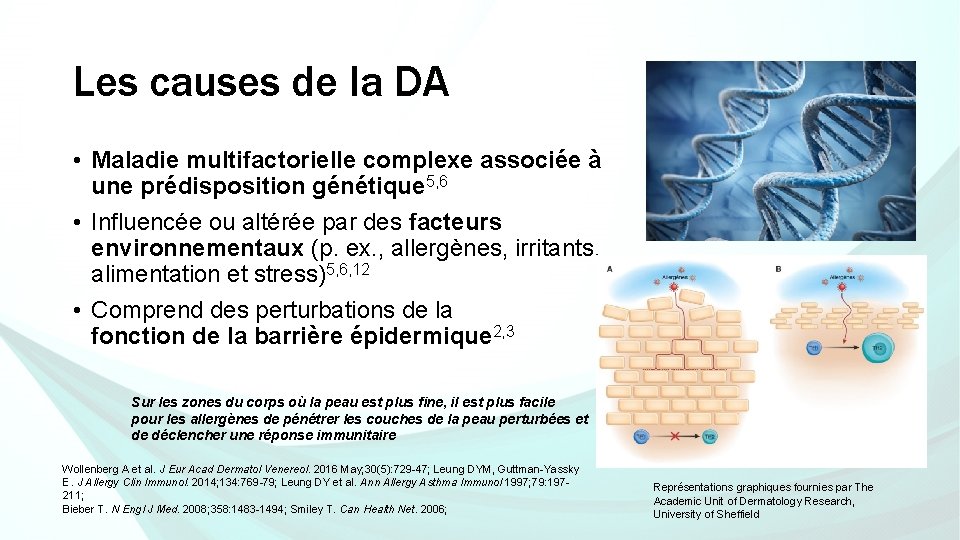 Les causes de la DA • Maladie multifactorielle complexe associée à une prédisposition génétique