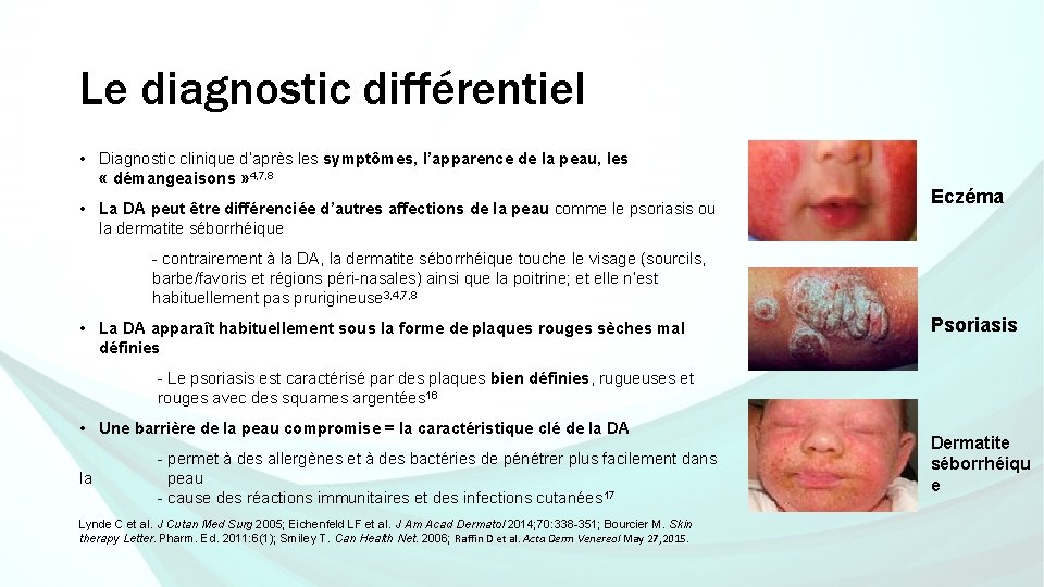 Le diagnostic différentiel • Diagnostic clinique d’après les symptômes, l’apparence de la peau, les