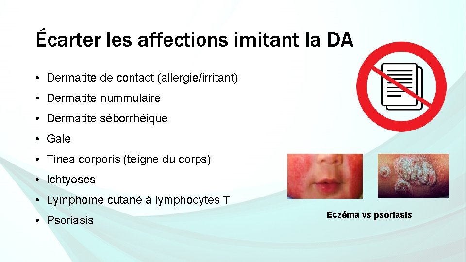 Écarter les affections imitant la DA • Dermatite de contact (allergie/irritant) • Dermatite nummulaire