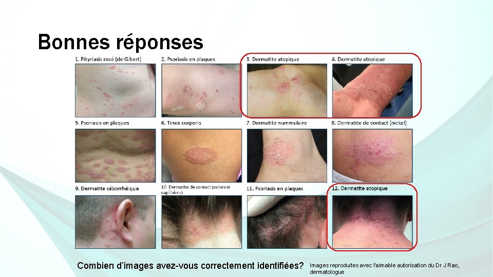 Bonnes réponses Combien d’images avez-vous correctement identifiées? Images reproduites avec l’aimable autorisation du Dr