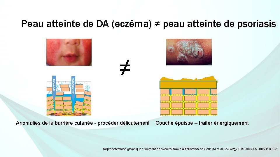 Peau atteinte de DA (eczéma) ≠ peau atteinte de psoriasis ≠ Anomalies de la Peau atteinte de DA (eczéma) ≠ peau atteinte de psoriasis ≠ Anomalies de la